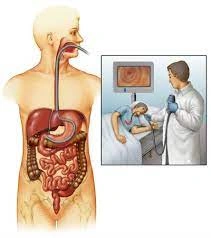 Stomach Cancer Treatment in Kanpur