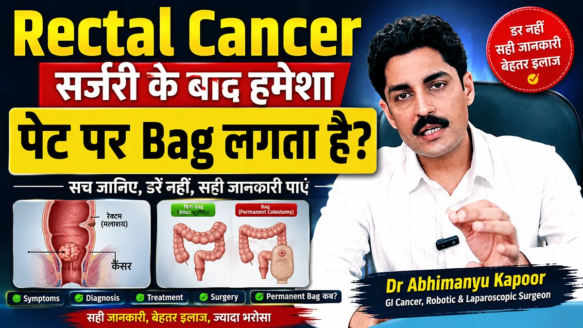 Rectal Cancer Surgery Rectal Cancer Surgery