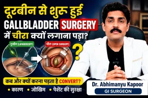 Why Is a Cut Needed After Laparoscopic Gallbladder Surgery? | Laparoscopy to Open Surgery